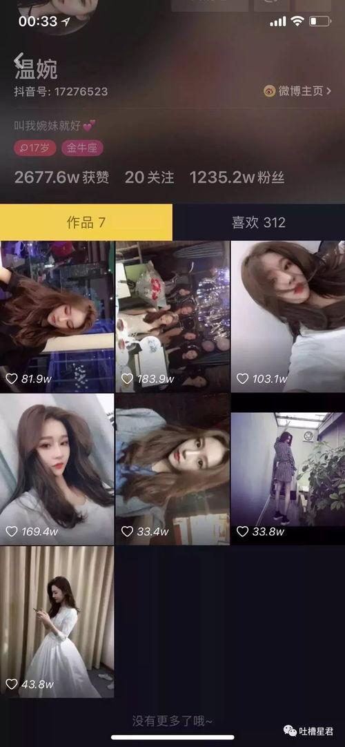 免费吃抖音网红瓜,揭秘网红幕后生活